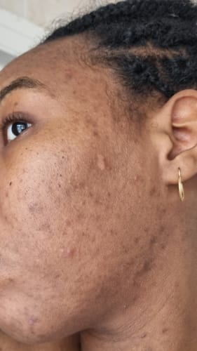 Customer photo review of Turmeric Glow Soap