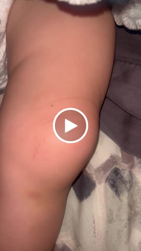 Customer video review of Nectar Repair Balm