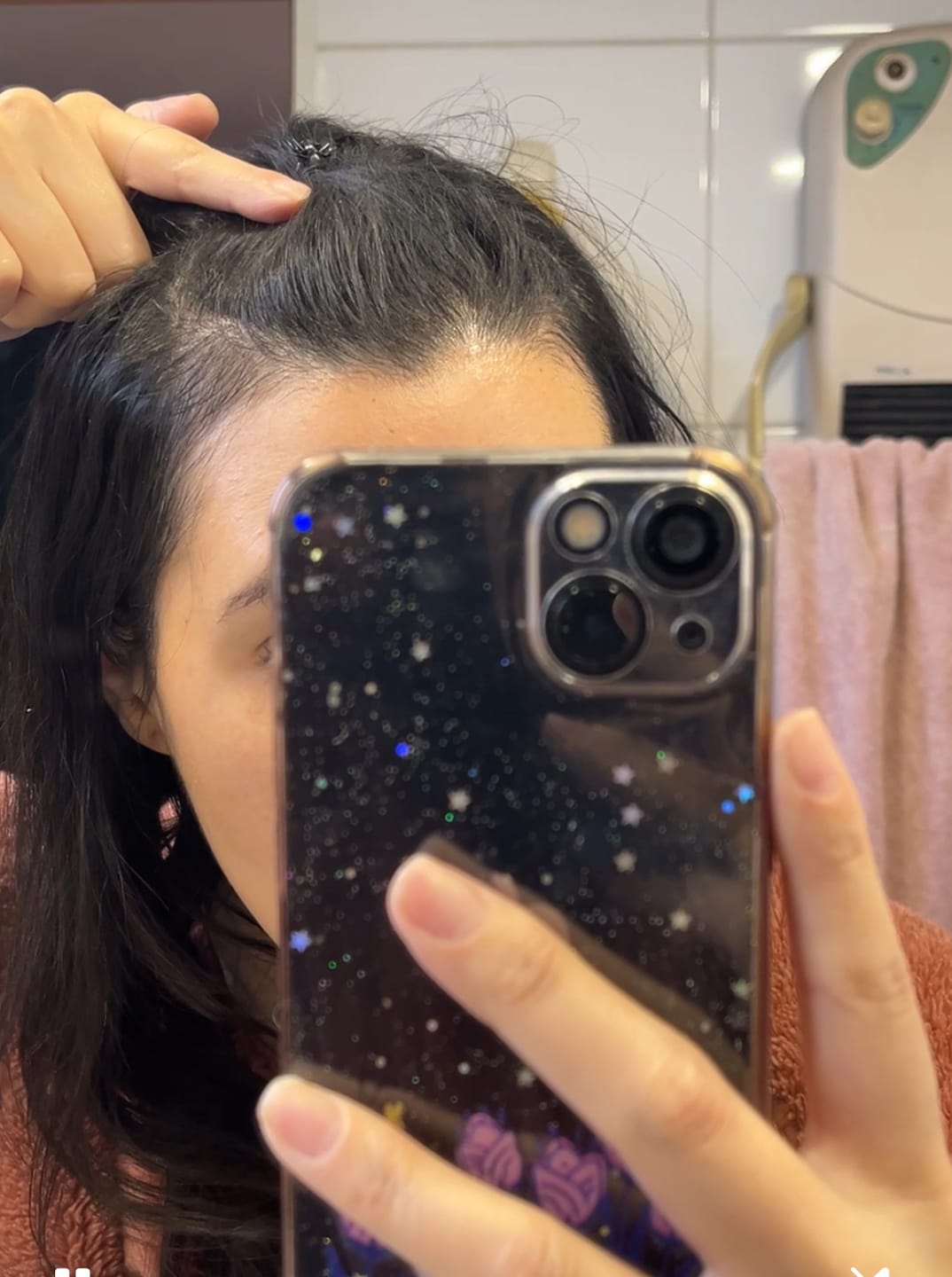 Customer photo review of Pack Anticaída de Cabello para 1 Mes