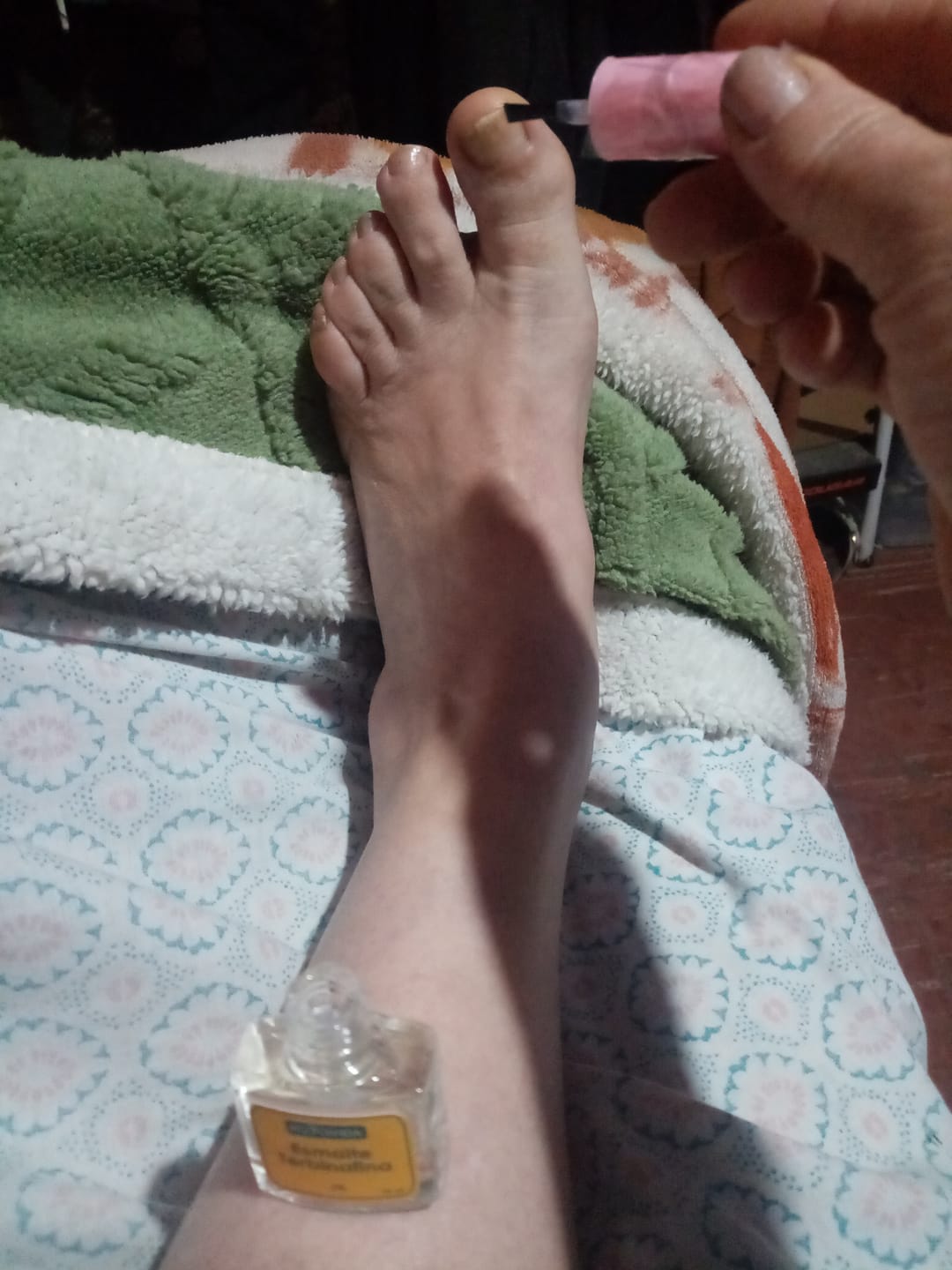 Customer photo review of Kit Bye Bye Hongos – Tratamiento Antimicótico para Uñas
