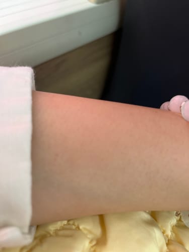 Customer photo review of Ulike Air10家用脫毛儀-裕美限時團購