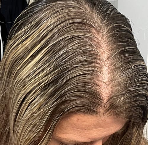 Customer photo review of Sunkissed Starter Kit