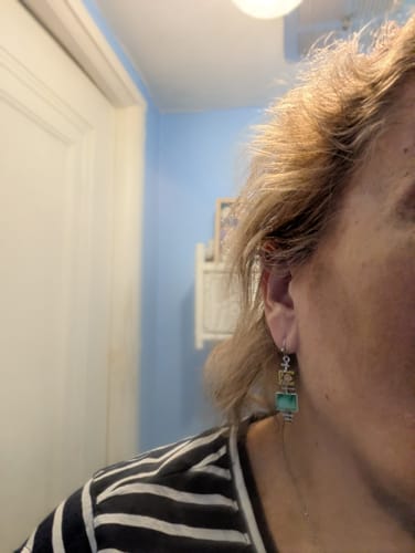 Customer photo review of Glov Hair Regrowth System