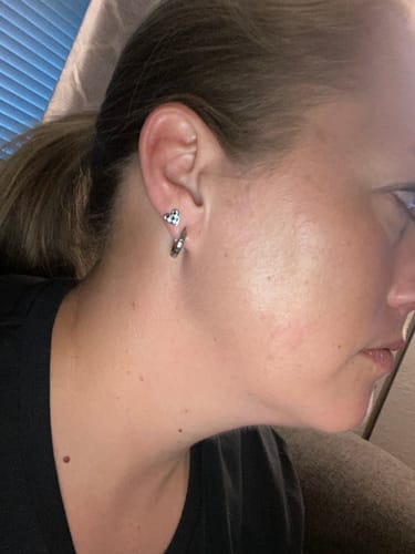 Customer photo review of Silver Keystone Huggies