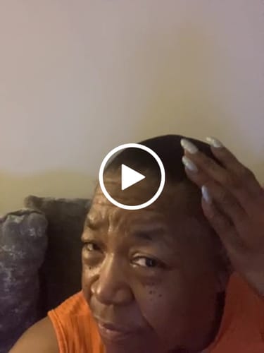 Customer video review of Rennora Hair Growth Serum