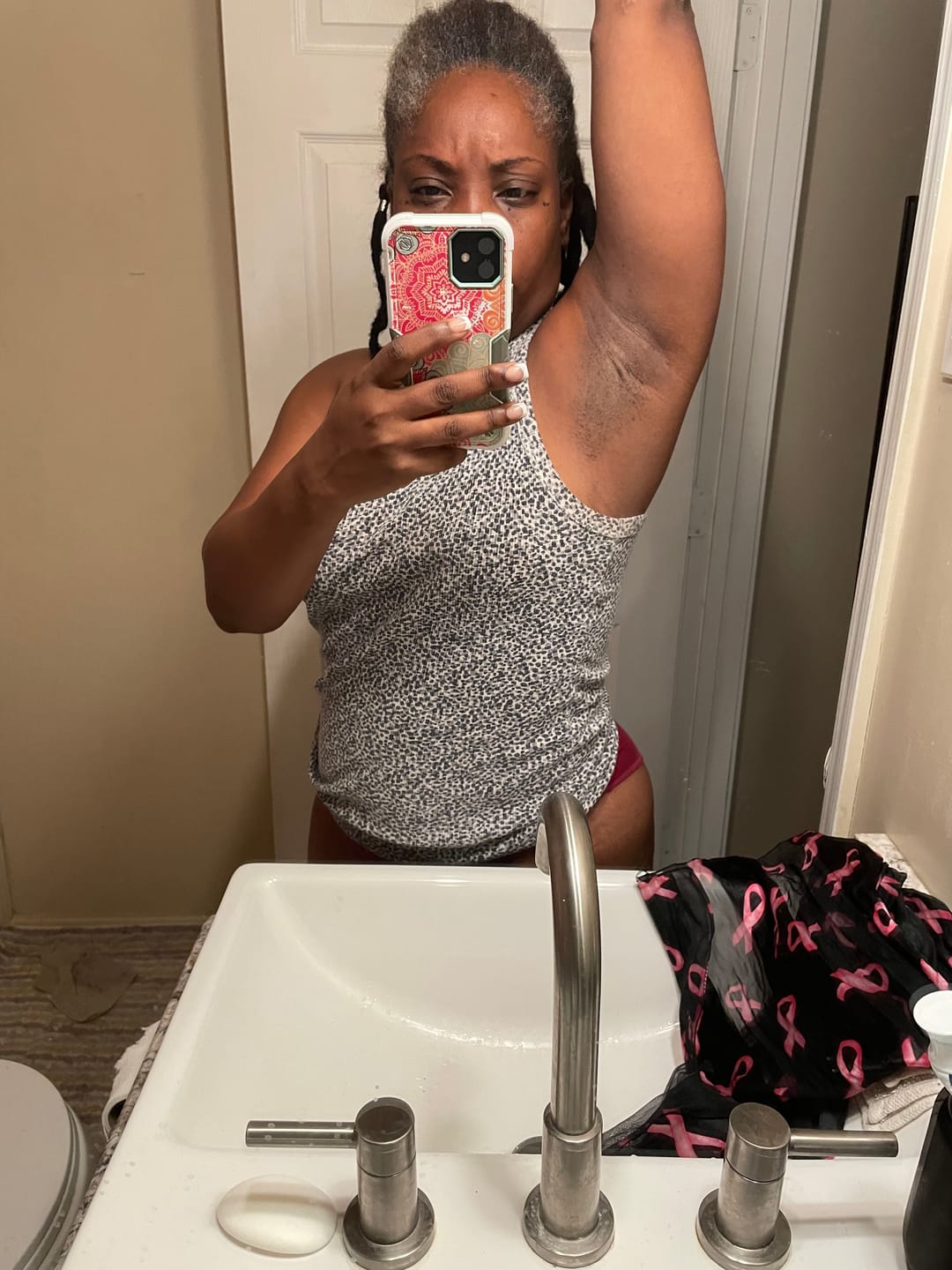 Customer photo review of Dark Spot Roller 50 ml (inner thighs and underarms)