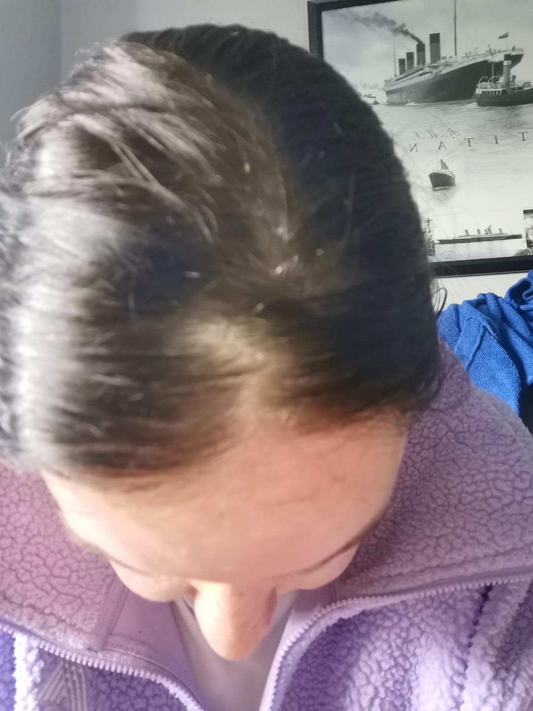 Customer photo review of The Magnet - Detox Shampoo