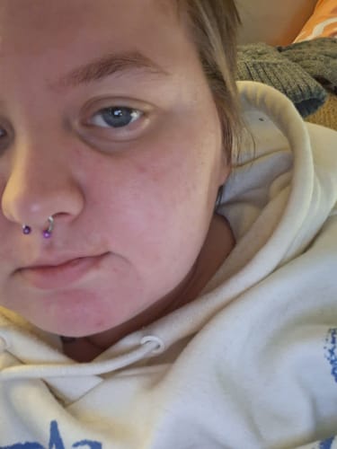 Customer photo review of IYKYK Daily Moisturiser