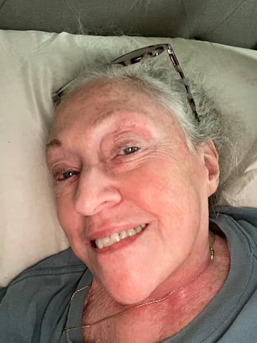 Customer photo review of Neptune Grass Fed Tallow & Honey Balm