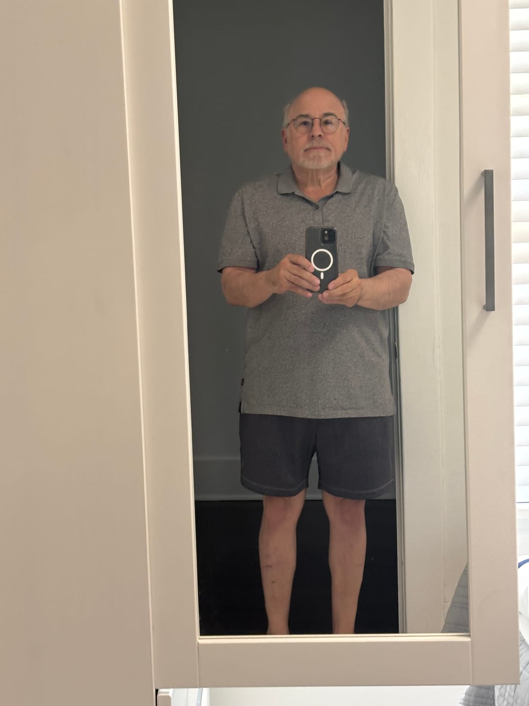 Customer photo review of Infinity Shorts 6 Inch