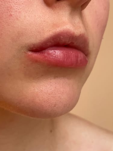 Customer photo review of COSTIQ® LONG LASTING LIP PLUMPER