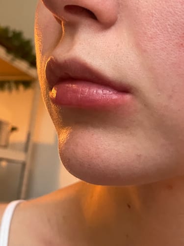 Customer photo review of COSTIQ® LONG LASTING LIP PLUMPER