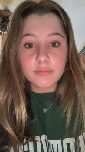 Customer photo review of GOLD PURE VITAMIN BRIGHTENING SERUM