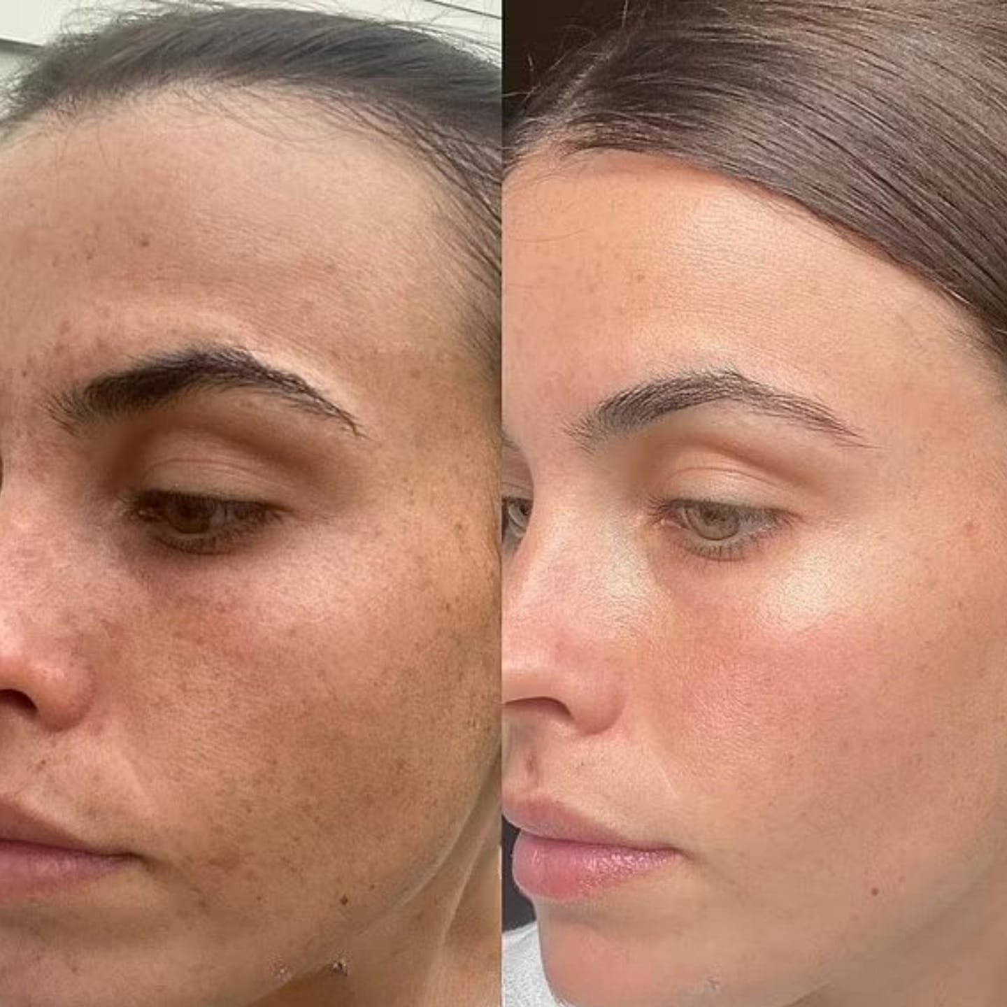 Customer photo review of Antioxidant Booster Serum