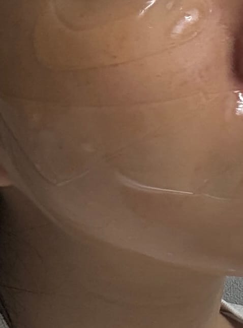 Customer photo review of Madeca Lab PDRN Skin Tightening Glow Gel Mask 5ea