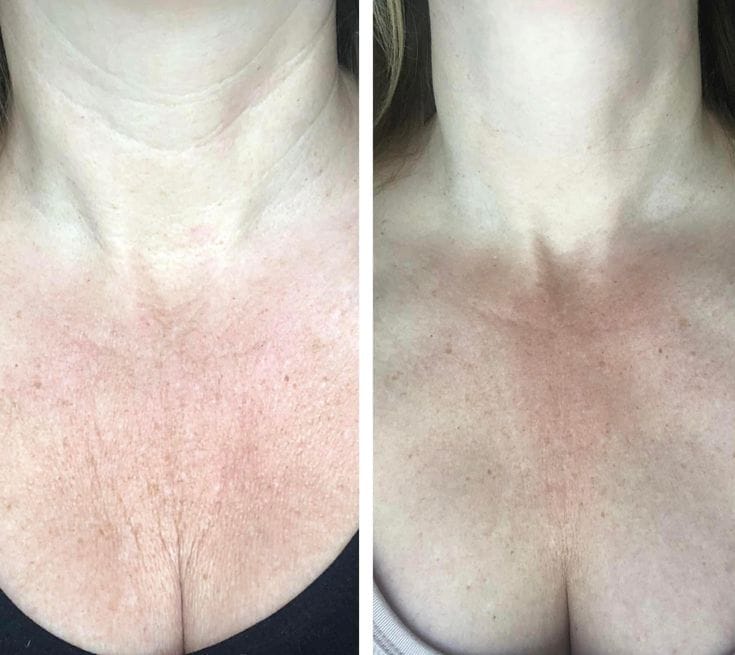Customer photo review of Rutina rostro, cuello y escote. Aceite de rosa mosqueta + crema facial
