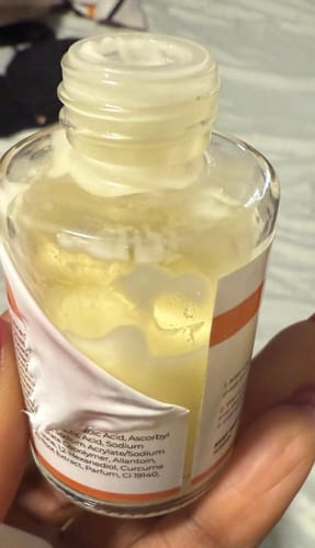 Customer photo review of Turmeric Face Milk (with AHA & BHA)