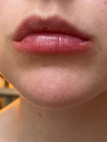 Customer photo review of COSTIQ® LONG LASTING LIP PLUMPER