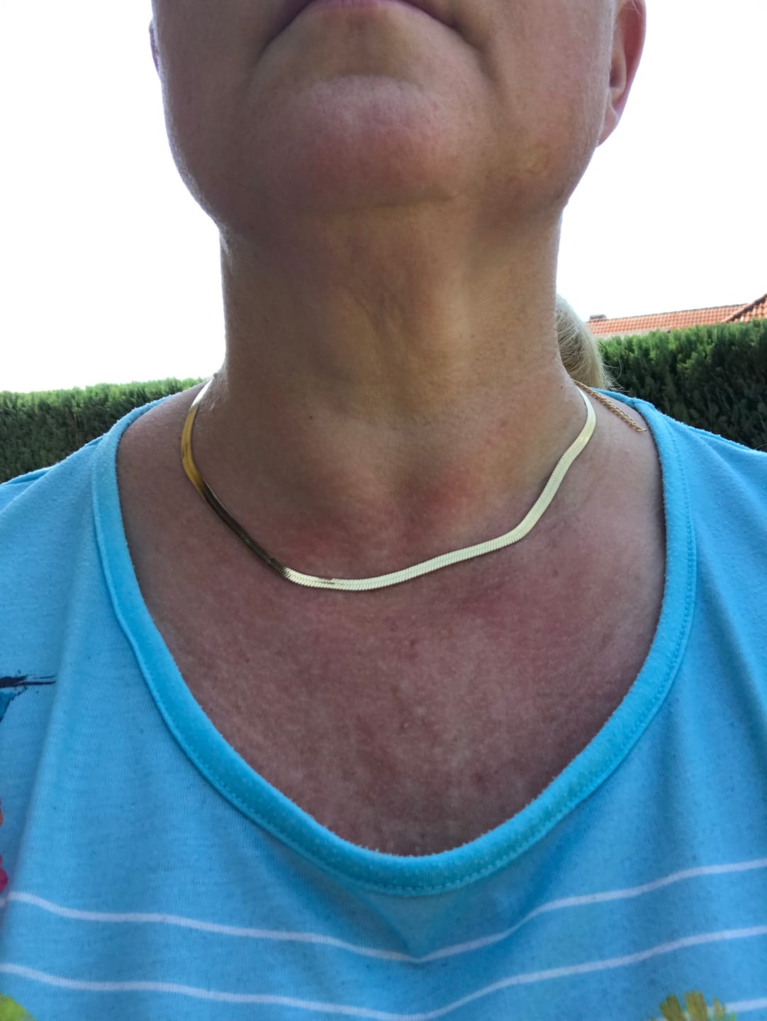 Customer photo review of Snake Skin Kette | 18K vergoldet