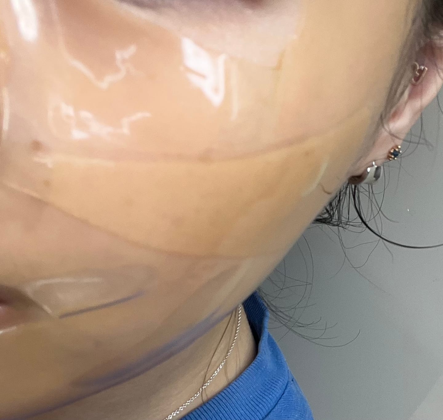 Customer photo review of Madeca Lab PDRN Skin Tightening Glow Gel Mask 1ea