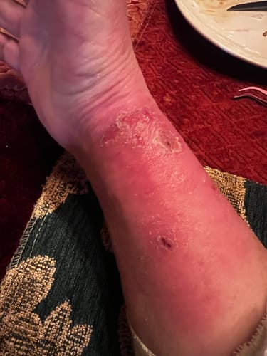 Customer photo review of Miracle Balm Tallow & Honey