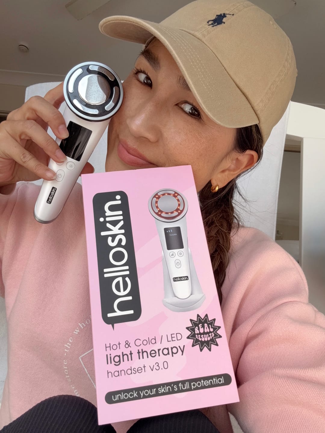 Customer photo review of hot/cold led light therapy handset v3