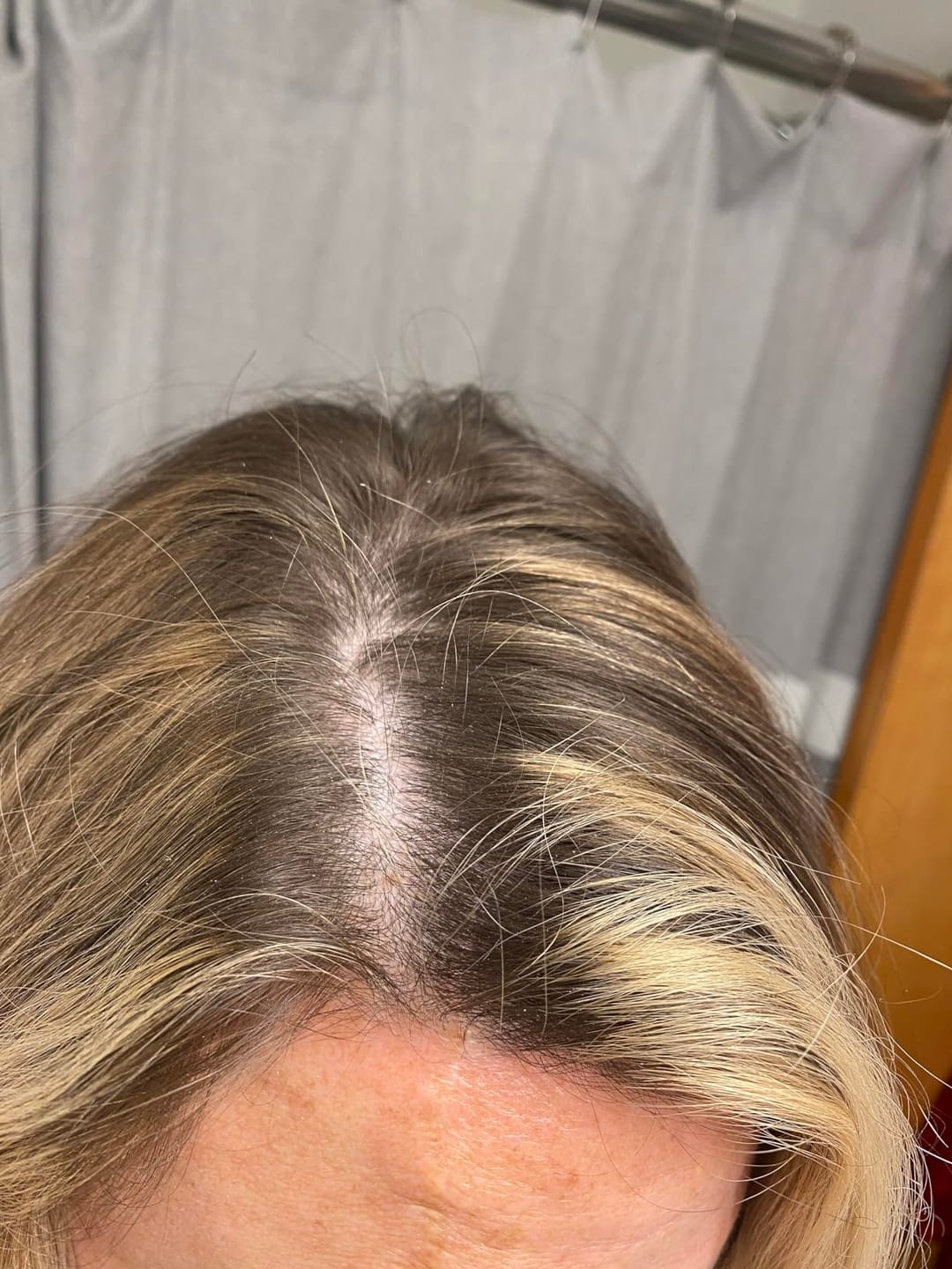 Customer photo review of Variety Pack - Dry Shampoo Powder | Natural & Organic Ingredients | Made in USA