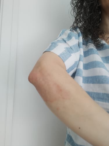 Customer photo review of Nurture & Shield Bundle