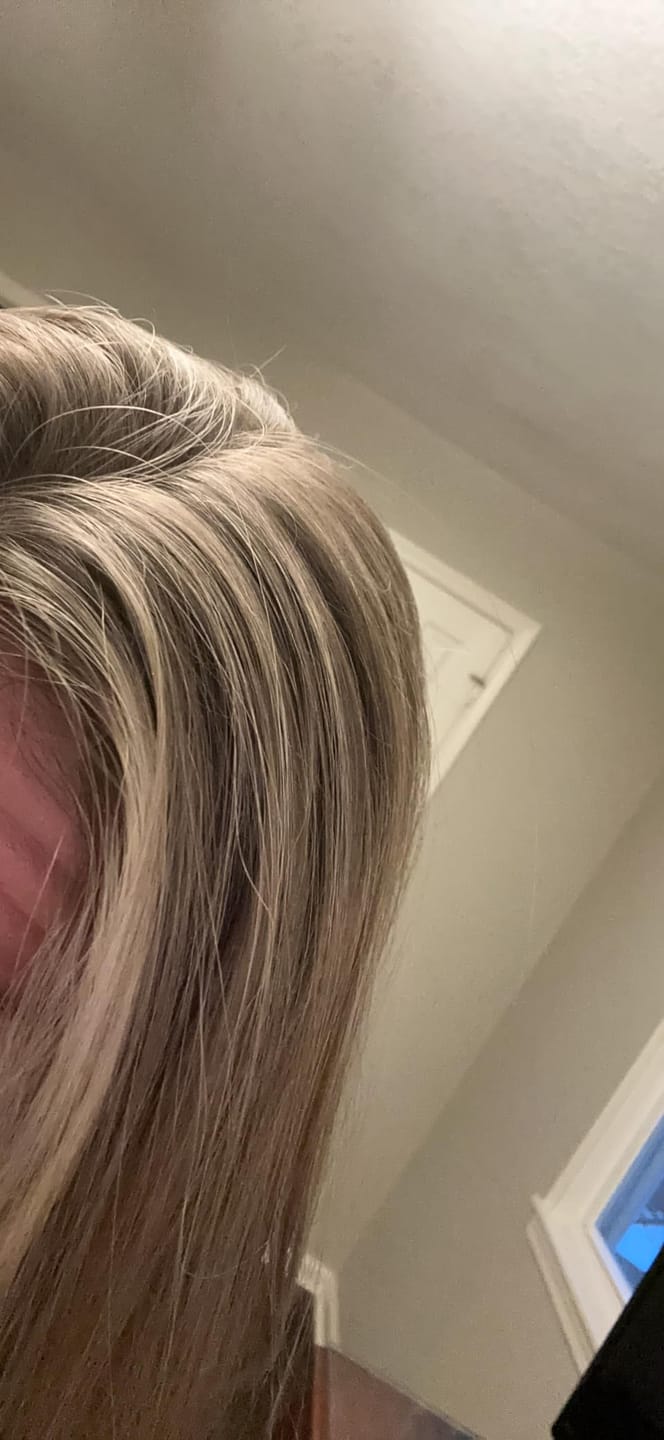 Customer photo review of Variety Pack - Dry Shampoo Powder | Natural & Organic Ingredients | Made in USA