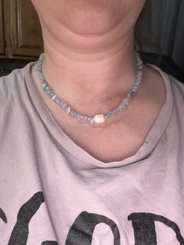 Customer photo review of Vexis