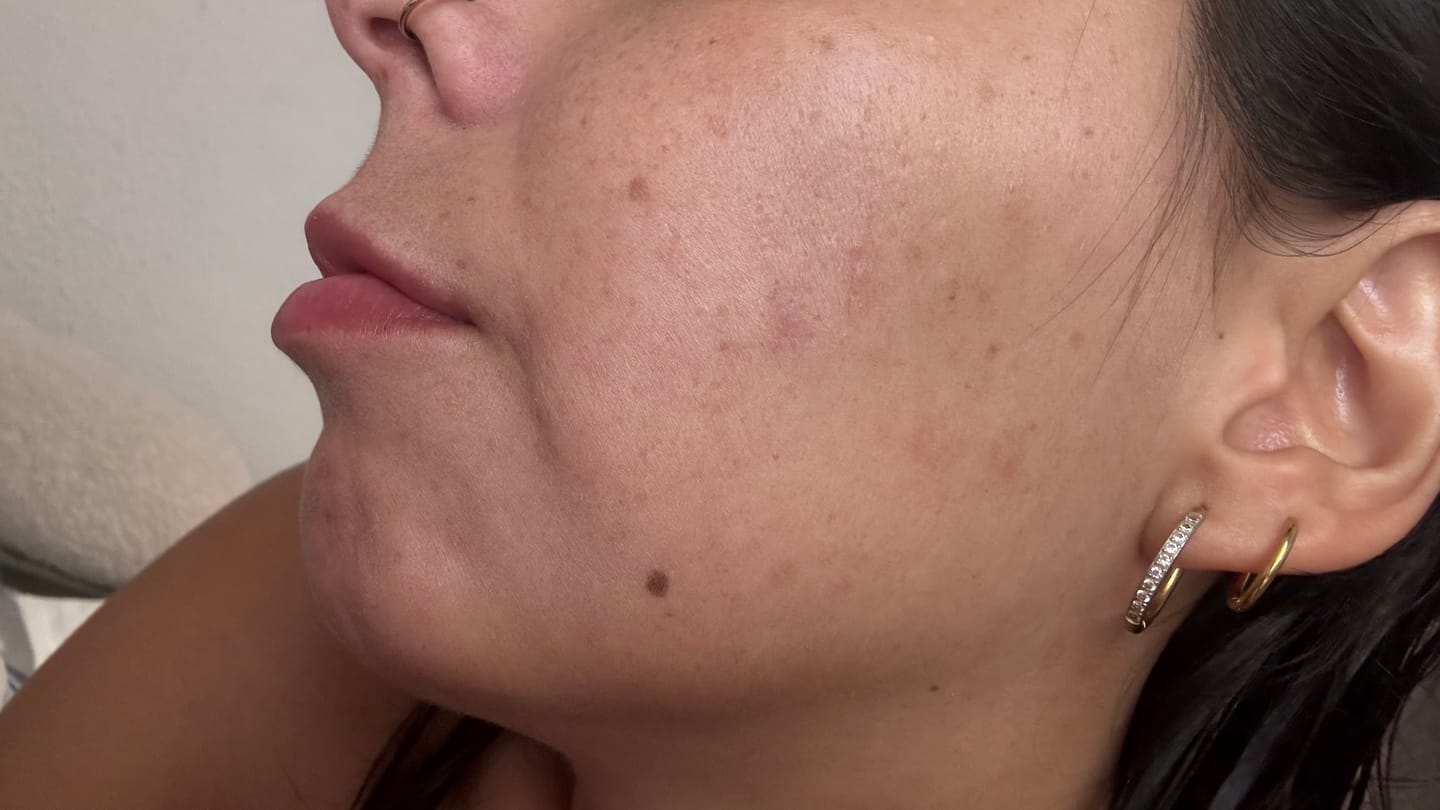 Customer photo review of CORTIZEN - MANEJO DEL ESTRÉS & SALUD HORMONAL