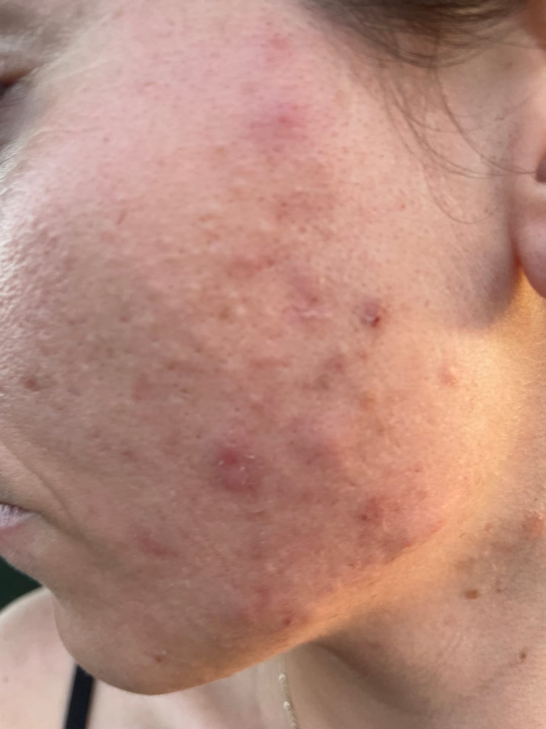 Customer photo review of A CONTROL + CORTIZEN - Equilibrio hormonal desde el cerebro, los ovarios, la piel y el metabolismo.