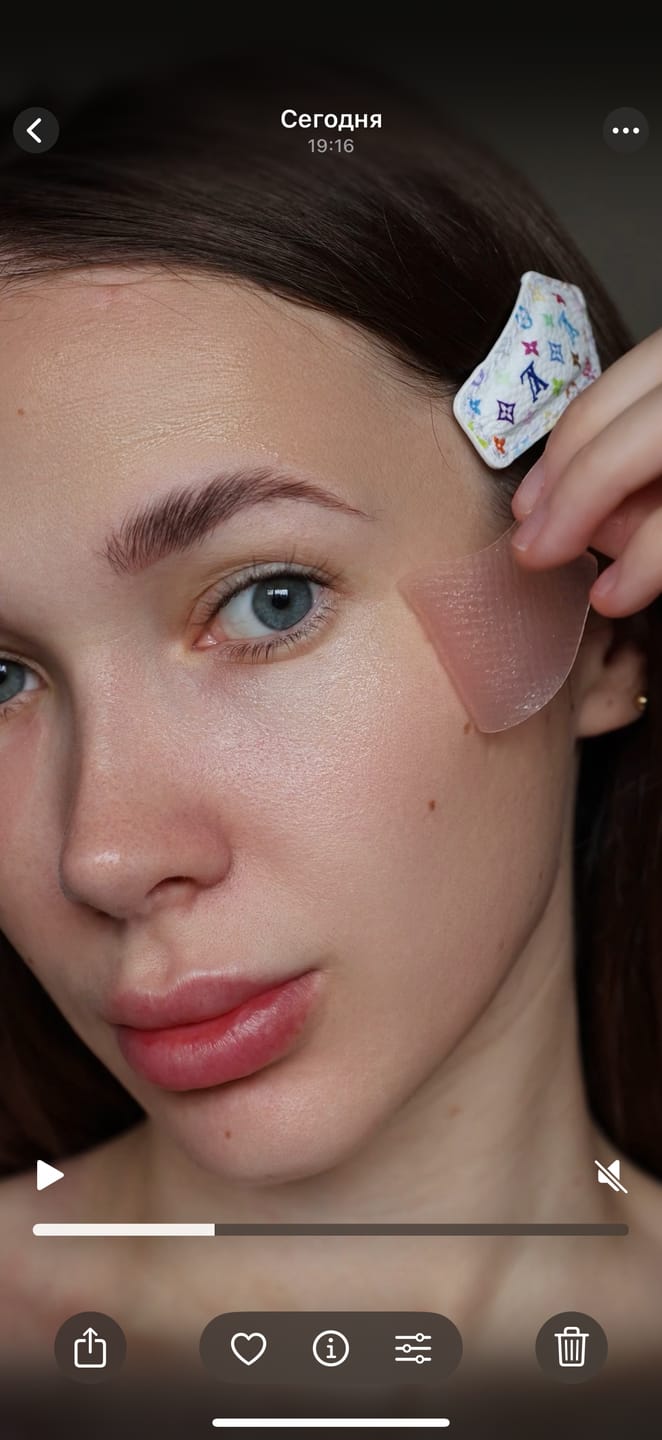 Customer photo review of PDRN retinal eye patch Glow jelly