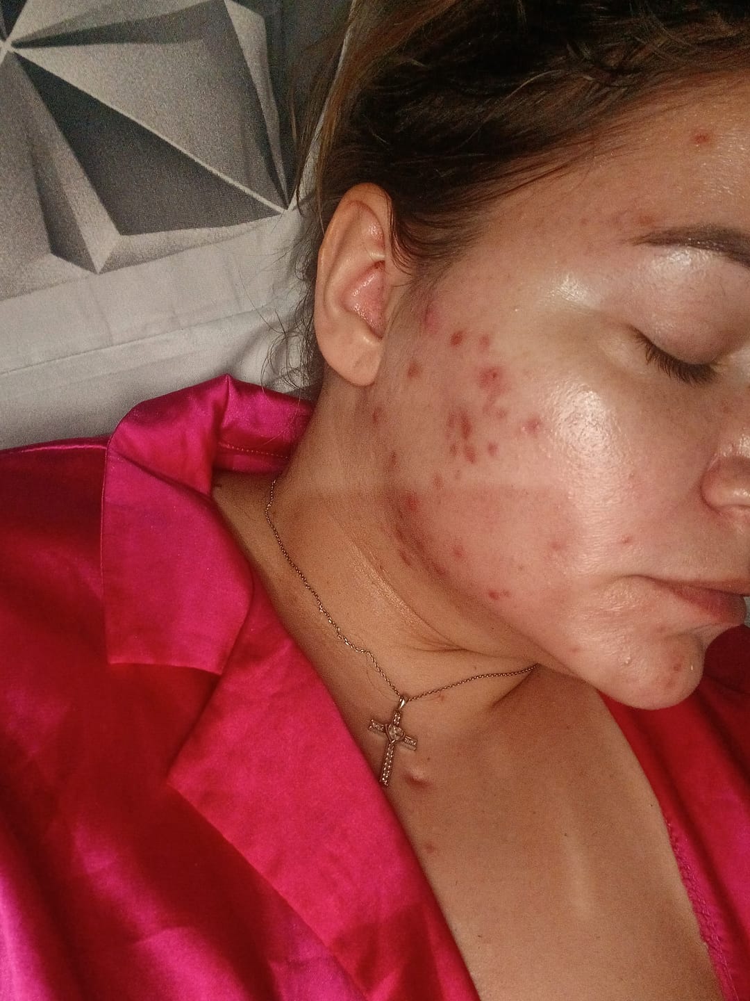 Customer photo review of The Ordinary Niacinamide 10% + Zinc 1%