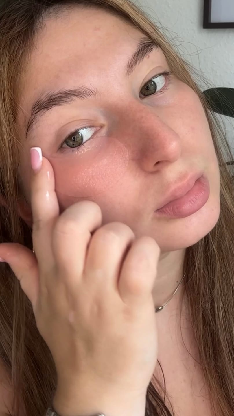 Customer photo review of PDRN retinal eye patch Glow jelly
