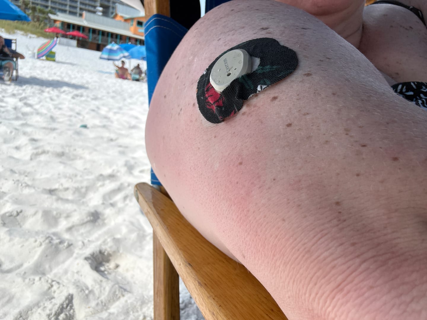 Customer photo review of Skin Grip Original - Dexcom G7 & Stelo Adhesive Patches (With Cutout)