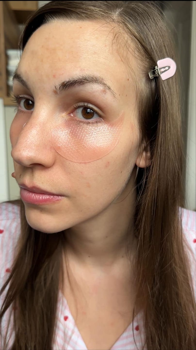 Customer photo review of PDRN retinal eye patch Glow jelly