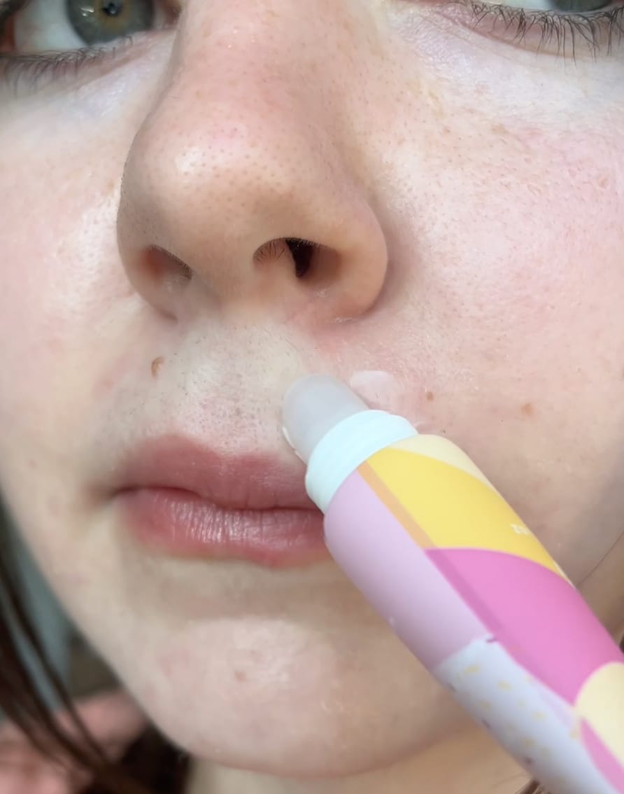 Customer photo review of Hair Removal Trilogy Kit