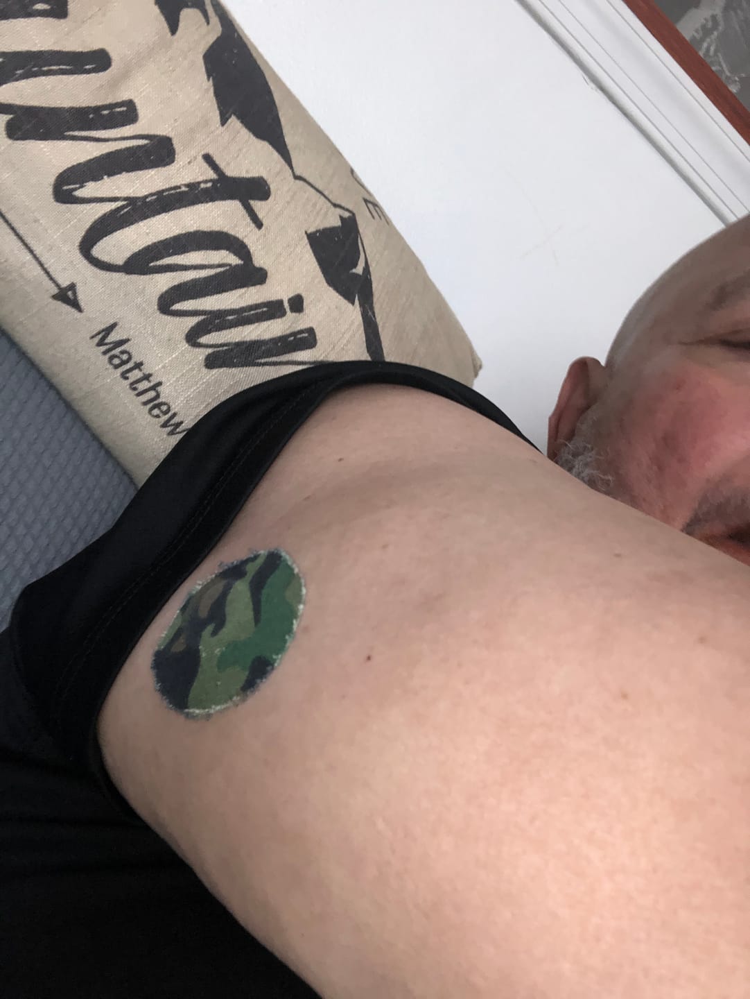 Customer photo review of Skin Grip Original - Libre 3 Adhesive Patches