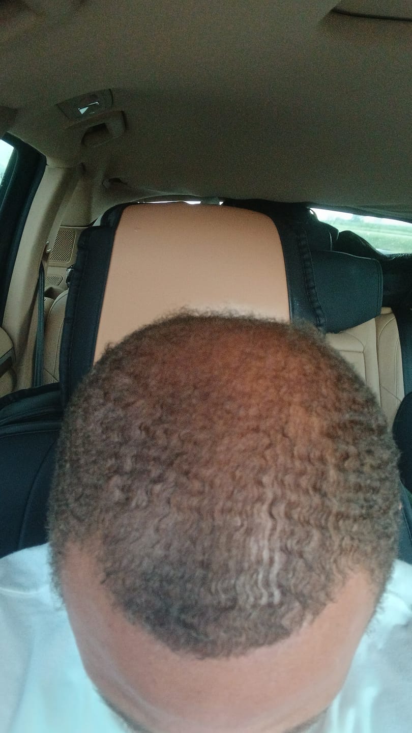 Customer photo review of Batana Oil for Hair