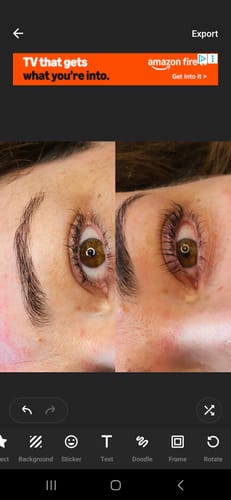 Customer photo review of TGA vs Cysteamine