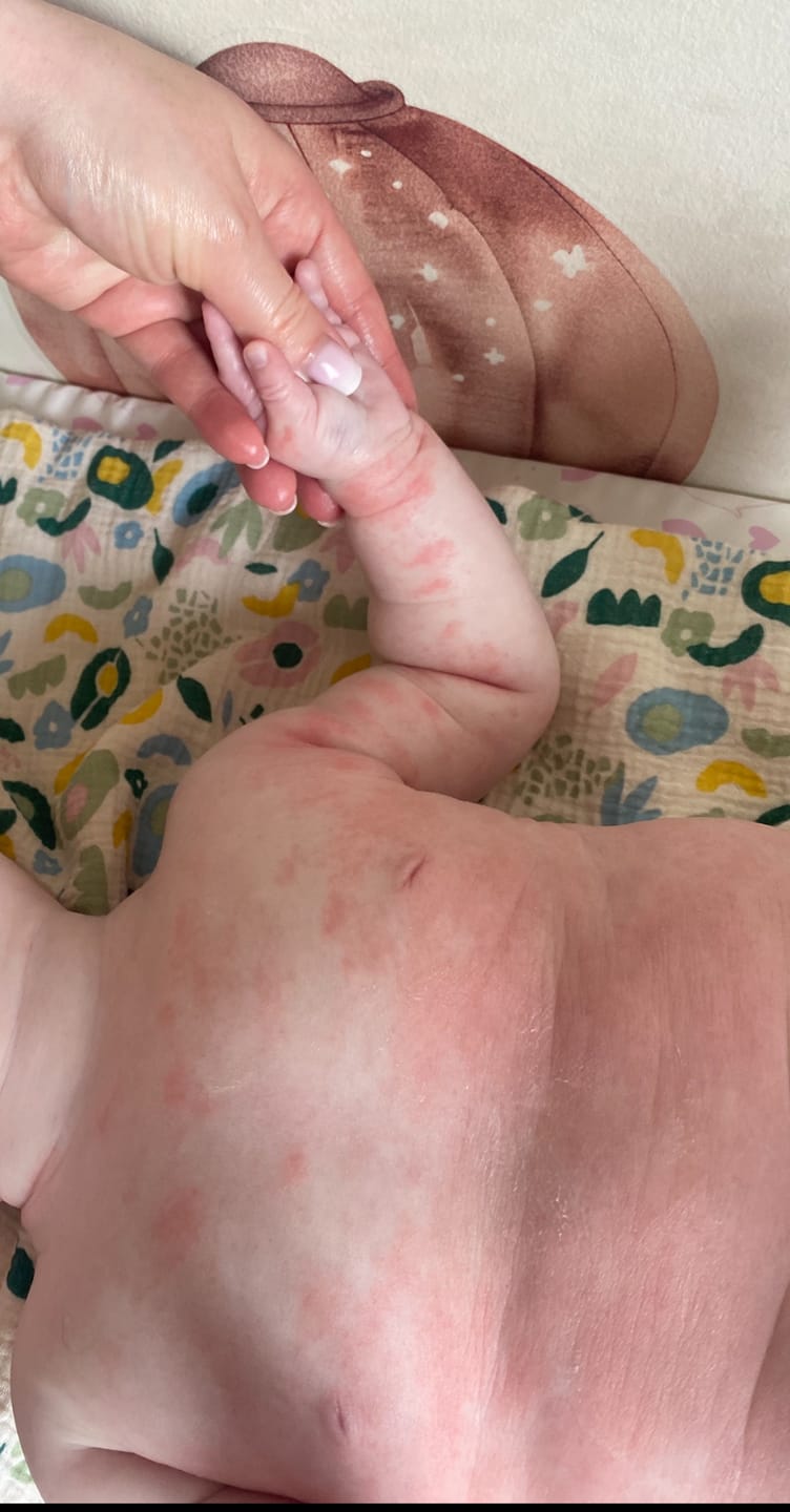 Customer photo review of Bioskin Junior Duo Pack