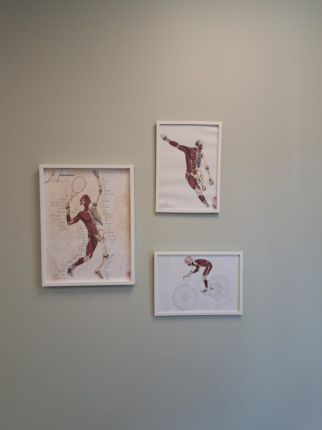Customer photo review of Planche anatomique du sprinteur