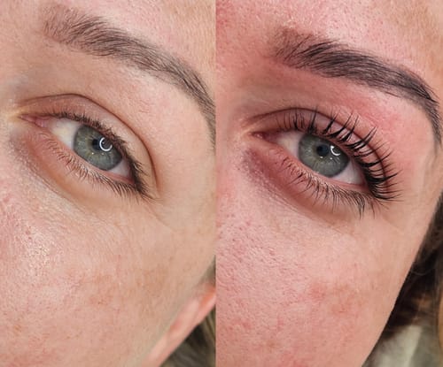 Customer photo review of TGA vs Cysteamine