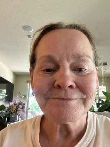 Customer photo review of Neptune Grass Fed Tallow & Honey Balm