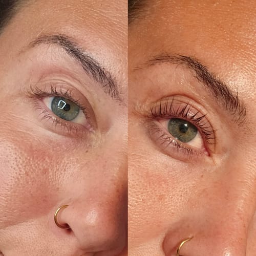 Customer photo review of TGA vs Cysteamine