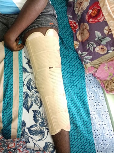 Customer photo review of Knee Brace - Long (19" Brace) | Ideal firm Knee support that limits knee motion & stabilizes the knee with mediolateral metal supports | Color - Beige