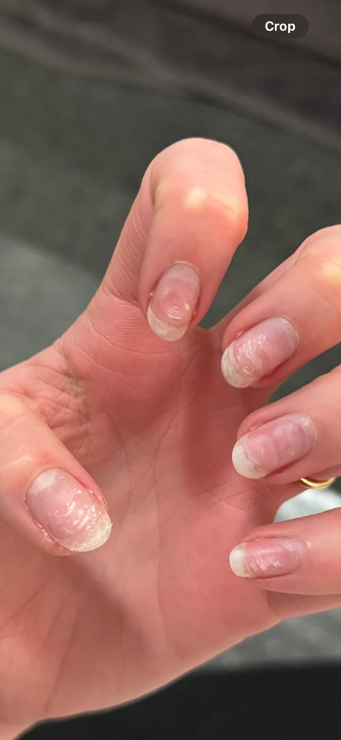 Customer photo review of Nude Pink Ombre DIY Semicured Gel Nail Sticker Kit