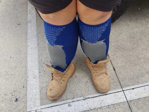 Customer photo review of ReliveX™ Compression Socks
