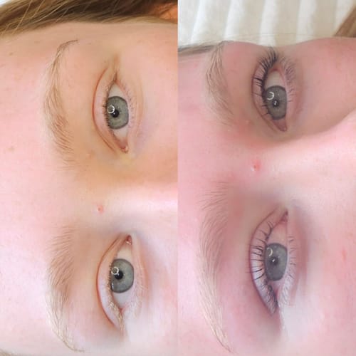Customer photo review of TGA vs Cysteamine